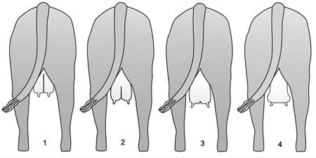 Formas possíveis de úberes Figura 1: Ligamento médio proeminente do suspensório fixando o úbere na cavidade. As tetas são mantidas perpendiculares ao chão.