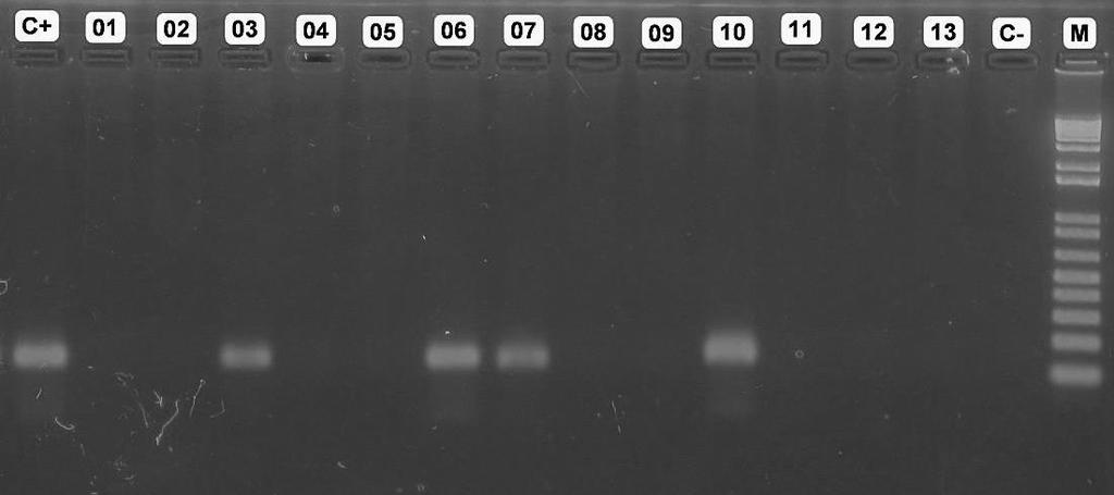 Perfil eletroforético em gel de agarose a 1,5% com produtos amplificados por PCR para os primers específicos de HPV 18.