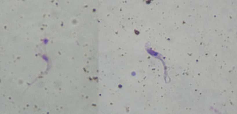Figura 6.Tripanossomatídeos morfologicamente similares a T. cruzi detectados em lâminas com fezes de T. sordida coradas com Giemsa. Esquerda: tripomastigota. Direita: epimastigota. Figura 7.