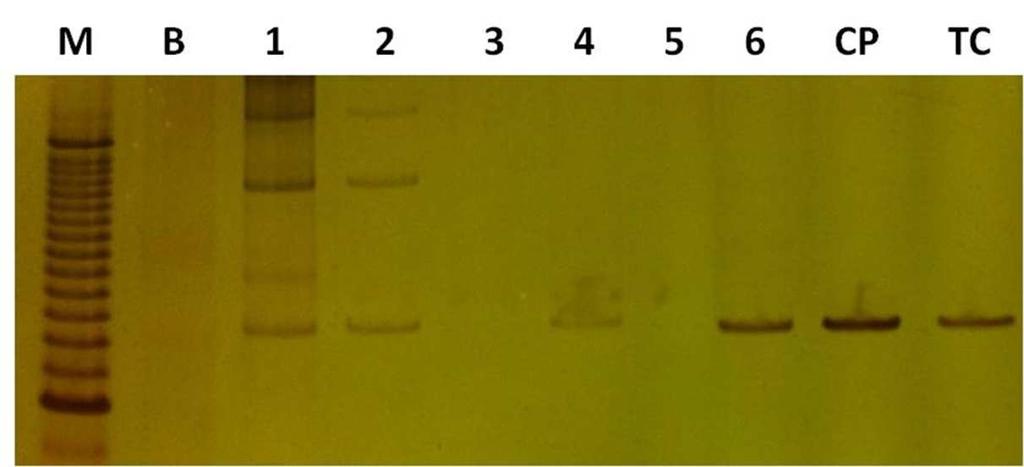 M: marcador de peso molecular; B: branco; 1 a 6: Amostras intestinais de Triatoma sordida; CP: Controle Positivo (amostra intestinal de Panstrongylus megistus positiva para Trypanossoma cruzi); TC: