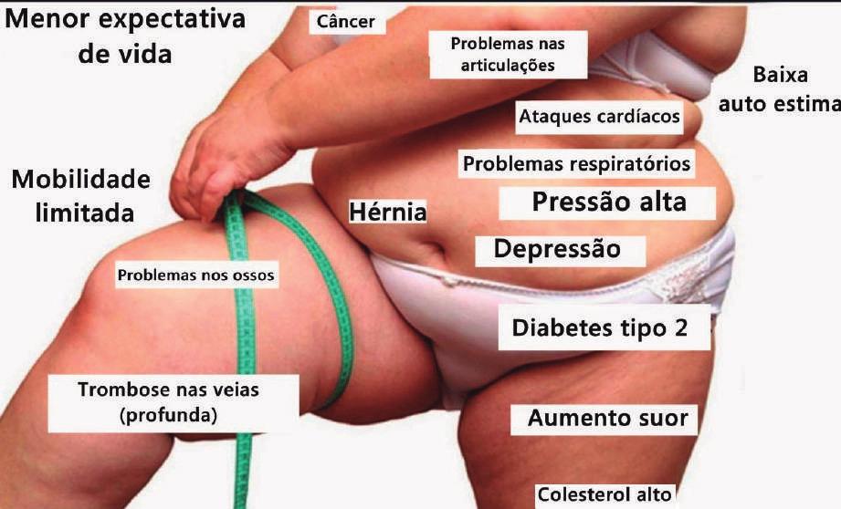 OS EFEITOS NEGATIVOS DA OBESIDADE NA SUA SAÚDE E NA SUA VIDA A prevalência de sobrepeso e obesidade vem aumentando rapidamente no mundo, sendo considerada um importante problema de saúde pública