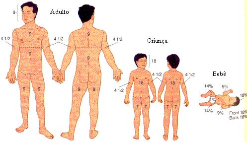 Assim, segundo a regra dos nove, a cabeça e o pescoço do adulto representam 9% da superfície corporal, cada membro superior 9% (9 + 9 = 18%), cada membro inferior 18% (18 + 18 = 36%), o tronco