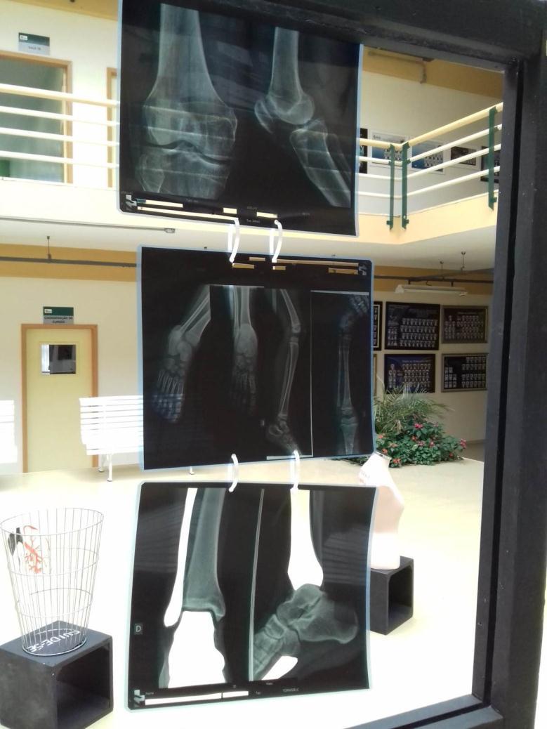 Fotografia 3 Trabalho com reaproveitamento de radiografias intitulado Na Transparência do Corpo, a Silhueta do Destino.