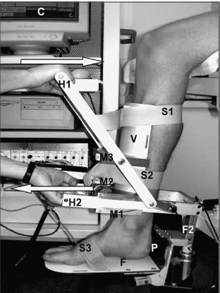 Figura 3.2 - QAAT. Tíbia imobilizada por (V) usando as cintas (S1) e (S2). Pé seguro pela plataforma (F) usando a cinta (S3).
