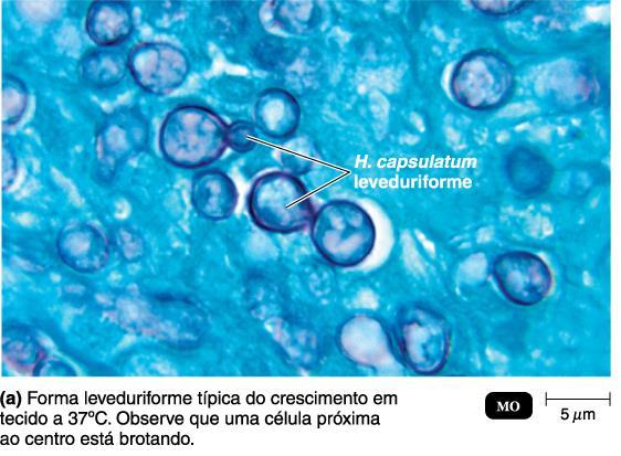 capsulatum (ascomiceto) um