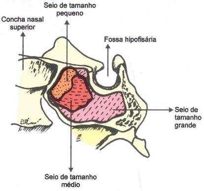 . SEIOS ETMOIDAIS- É formado pelo conjunto de pequenas cavidades, denominadas células etmoidais.