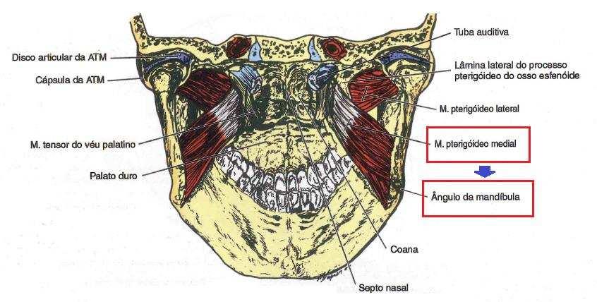 A- temporal B- Pterigóideo medial C- Masseter E Bucinador Resposta: B Comentário: Conforme visto em aula, a inserção do músculo pterigóideo medial é na face interna do ângulo mandibular, na