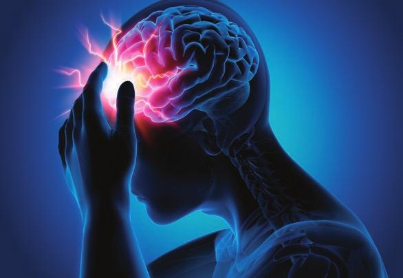 NEUROLOGIA Fatores de melhora: Na migrânea e nas cefaleias que têm como mecanismo fisiopatogênico uma dilatação das artérias cranianas, todos os procedimentos que diminuem o aporte de sangue para o