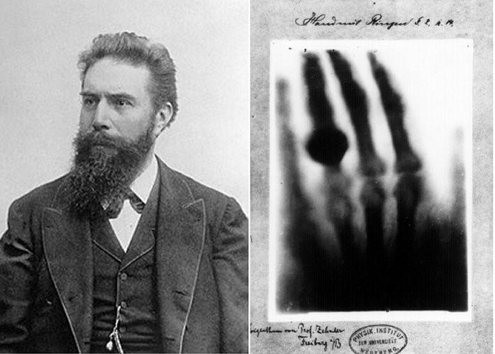 Figura 1: Imagem a esquerda: Wihelelm Conrad. Roentgen. Imagem a direita: primeira imagem de raio X médico realizado por Roentgen na mão de sua esposa Anna Bertha.
