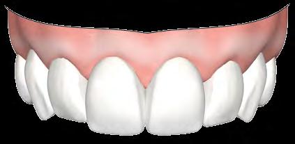 eficiente entre profissional e técnico em prótese dentária.