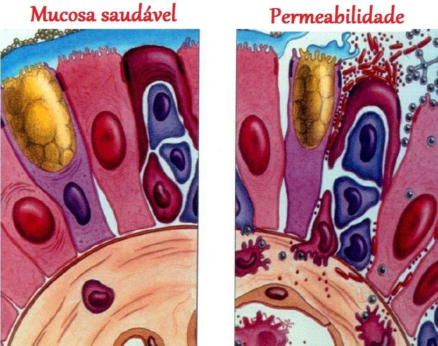 Entre os pacientes com TEA, 33 de 90 (36,7%) apresentaram permeabilidade intestinal Changes in the intestinal barrier in patients with