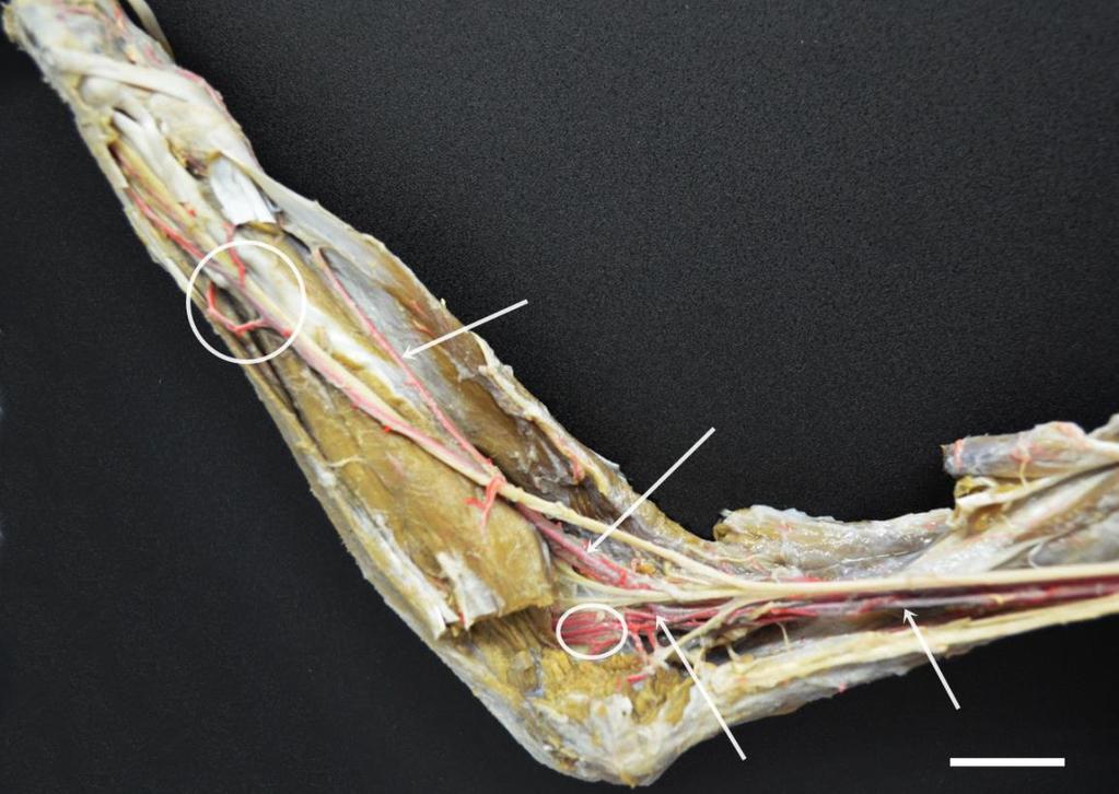 42 Segundo Wislocki (1928) com as espécies do gênero bradypus e choloepus o plexo na região ulnar desempenha a função que seria da artéria interóssea.