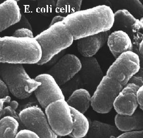 ETEC => enterotoxinas O agente Características: E.