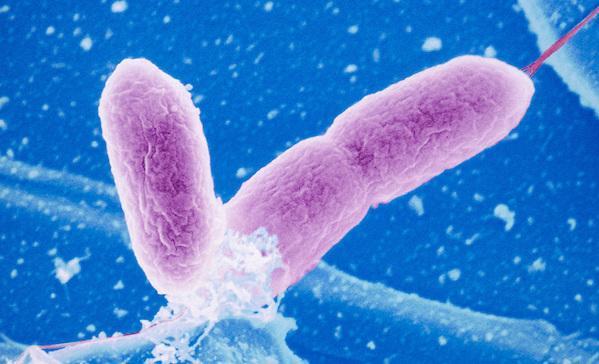 Plesiomonas CARACTERÍSTICAS, EPIDEMIOLOGIA, PATOGENIA Anteriormente Plesiomonadaceae, mas agora classificadas como