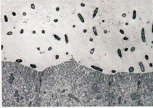 mediada por adesinas afimbriais; Formação de biofilmes; Invasão. Fimbrias de E.