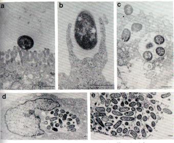 Salmonella (T3SS) Shigella (T3SS) Yersinia