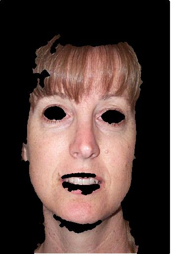 modelo protótipo deformável usado ao olho esquerdo e ao olho direito (d). Fig. 13: Fases do emparelhamento de um protótipo deformável para o olho numa imagem.
