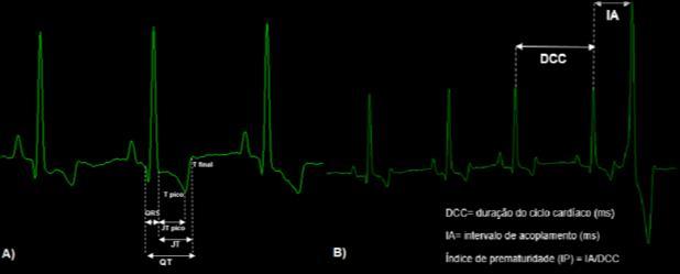 4 Cardiomiopatia arritmogênica do ventrículo direito em cães da raça boxer: atualidades no diagnóstico e tratamento mensuração de marcadores eletrocardiográficos.