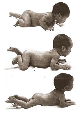 REFLEXO DE GALANT (ENCURVAMENTO DO TRONCO): Presente desde o nascimento desaparece no decorrer do 2º mês de vida.