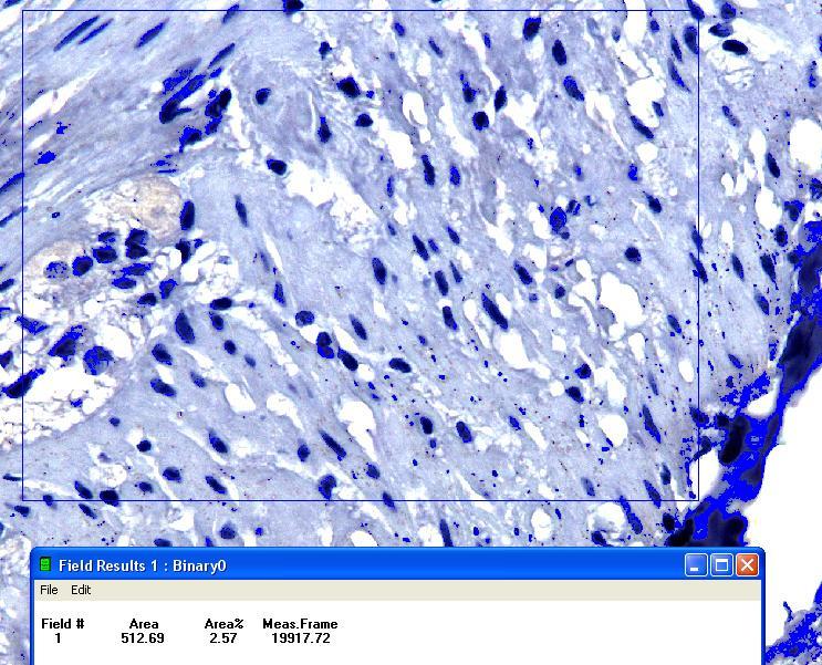 Análise Imuno-Histoquímica Analisaram-se as lâminas de imuno-histoquímica para HSP70 por um sistema de análise de imagens (QUANTIMET 520 - Leica).