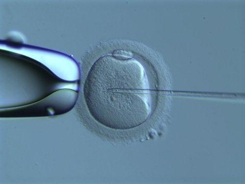 Injeção intracitoplasmática do espermatozoide (ICSI) Usada quando a FIV