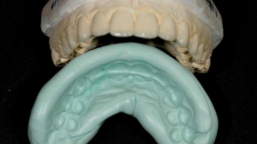 tamanho e anatomia adequada dos dentes.