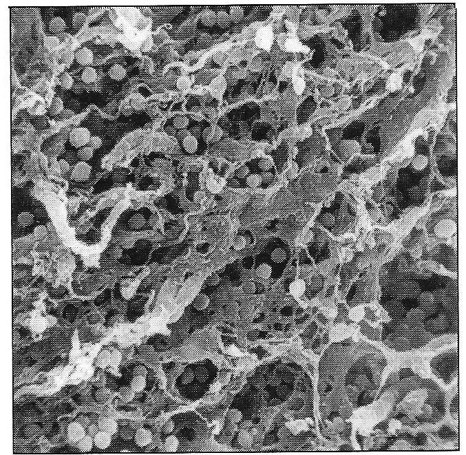 As células epiteliais do timo formam uma rede que sustenta