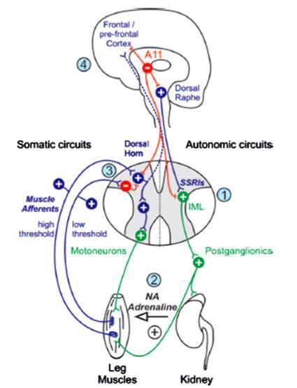 Síndrome de pernas inquietas Fisiopatologia Dopamina e ferro Perda da normal inibição dopaminergica A11 input sensorial para o cortex (sensação desconfortável ou urgência para o movimento) activação