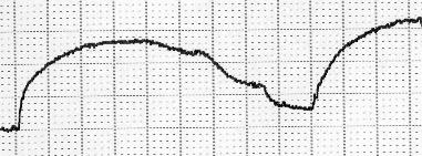 A 160 (5) 2g Tensão (%) 120 80 40 (4) 5min 0 0,5 1,5 5,0 B12 +B12 B 160 (5) 2g 5min Tensão (%) 120 80 40 (5)