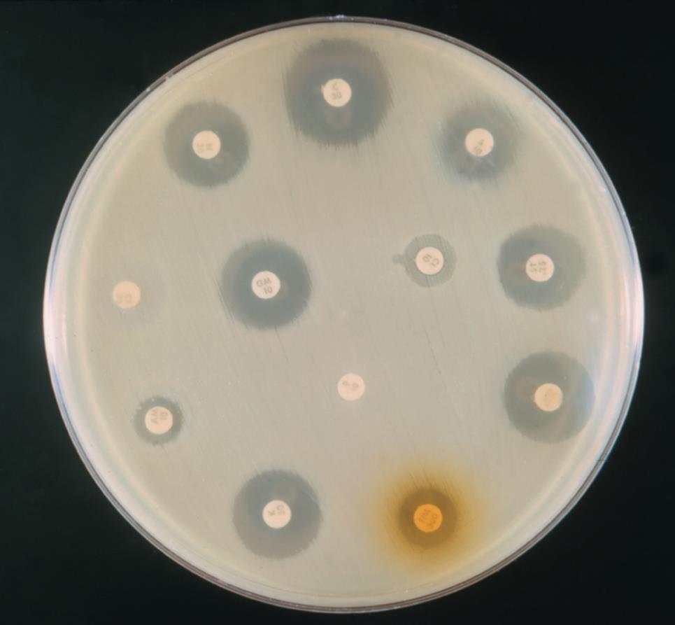 Testes de sensibilidade a antimicrobianos Teste de Disco-Difusão ou de Kirby-Bauer Método qualitativo Cada disco contém um agente