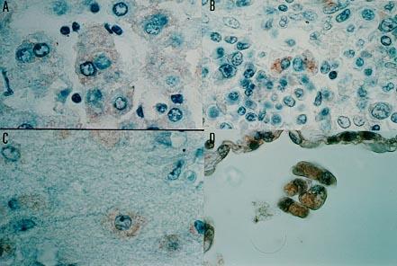 Febre Amarela - Diagnóstico laboratorial Amostra clínica: sangue ou