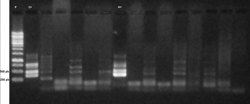 Figura 3 - Gel de Agarose 1% apresentando amostra positiva para Anaplasma phagocytophilum. P: Padrão, peso molecular 1Kb; C+: Controle Positivo, obtido após extração de DNA de cultivo celular de A.