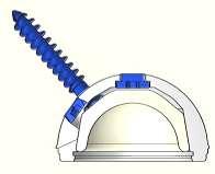 Os componentes supracitados, conectados entre si, destinam-se a substituição da articulação do quadril em procedimentos de artroplastia total.