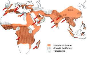 ANEMIA FALCIFORME