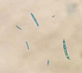 Nas unhas da pata esquerda 55,8% (106/190) foram identificados fungos filamentosos hialinos [Penicillium sp. 1,9% (2/106), Aspergillus sp. 3,8% (4/106), Fusarium sp. 1,9% (2/106), Scopulariopsis sp.