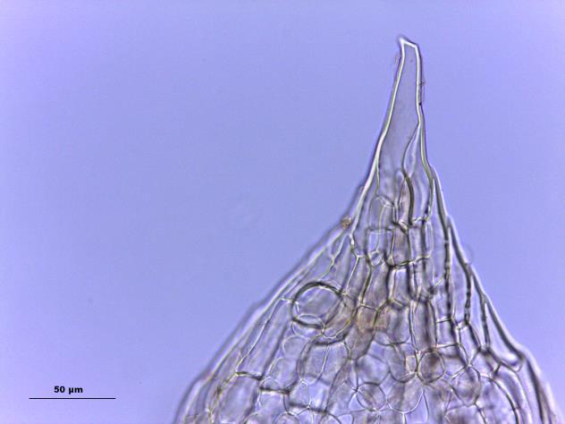 A. aspecto do gametófito seco, seta: