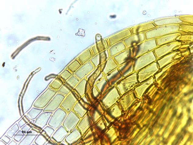 aspecto do gametófito seco, seta: ápice