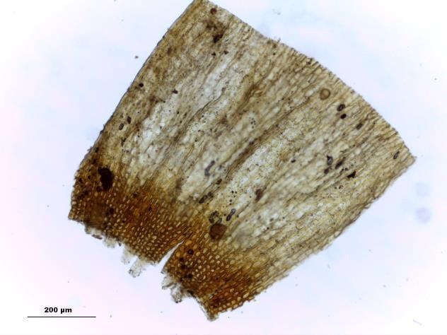F. esporófito, seta: células do