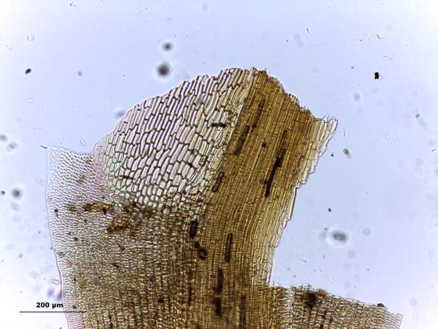 aspecto do gametófito seco, seta: ápice do filídio