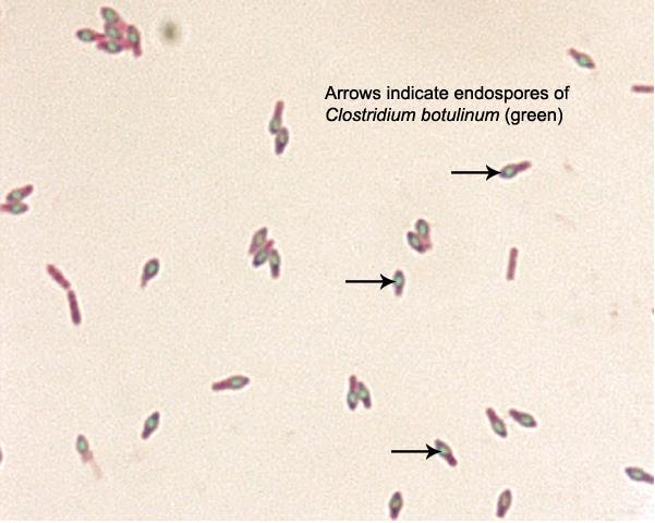 clostrídio neurotoxigênico.