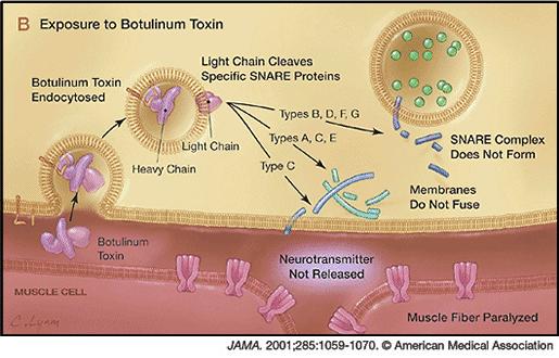 BOTULISMO ALIMENTAR 5 Neurotoxina Botulínica no Alimento Ingestão Absorção Sangue