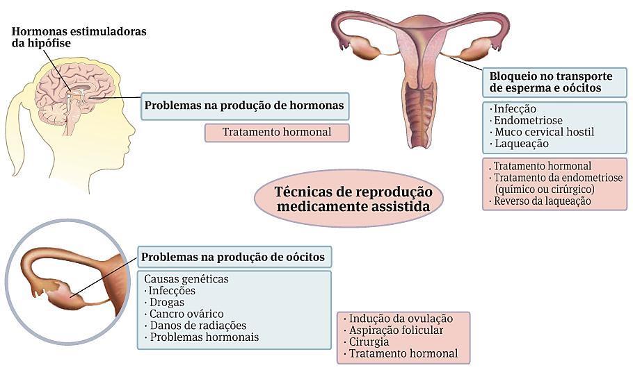 possíveis causas de infertilidade feminina e implementar