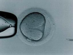 Manipulação da fertilidade Reprodução tecnicamente assistida Injeção Intracitoplasmática de Espermatozoides (ICSI) Perfuração do oócito com uma pipeta, contendo um espermatozoide selecionado.