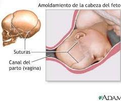 aos 4 ângulos