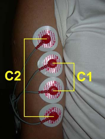 21 A atividade mioelétrica foi registrada a partir do ventre do músculo BB direito, por meio de dois pares de eletrodos em configuração bipolar.