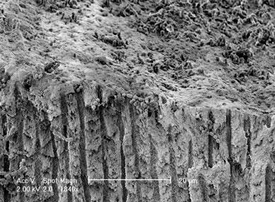 31 histologicamente no ápice de dentes com periodontite apical, isso facilita muito a invasão por bactérias aos túbulos dentinários (HAAPASALO; UDNAES; ENDAL, 2003; TRONSTAD; SUNDE, 2003).