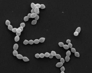58 2.2.2 Enterococcus faecalis Os Enterococcus spp. são bactérias gram-positivas anaeróbias facultativas que podem causar uma ampla variedade de doenças em humanos.