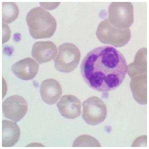 A cromatina apresenta-se densa com grande citoplasma, o qual possui uma cor rosada com fina