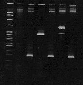 LEUCEMIA MIELÓIDE CRÔNICA Diagnóstico molecular t(9;22)(q34;q11) Cromossomo 22
