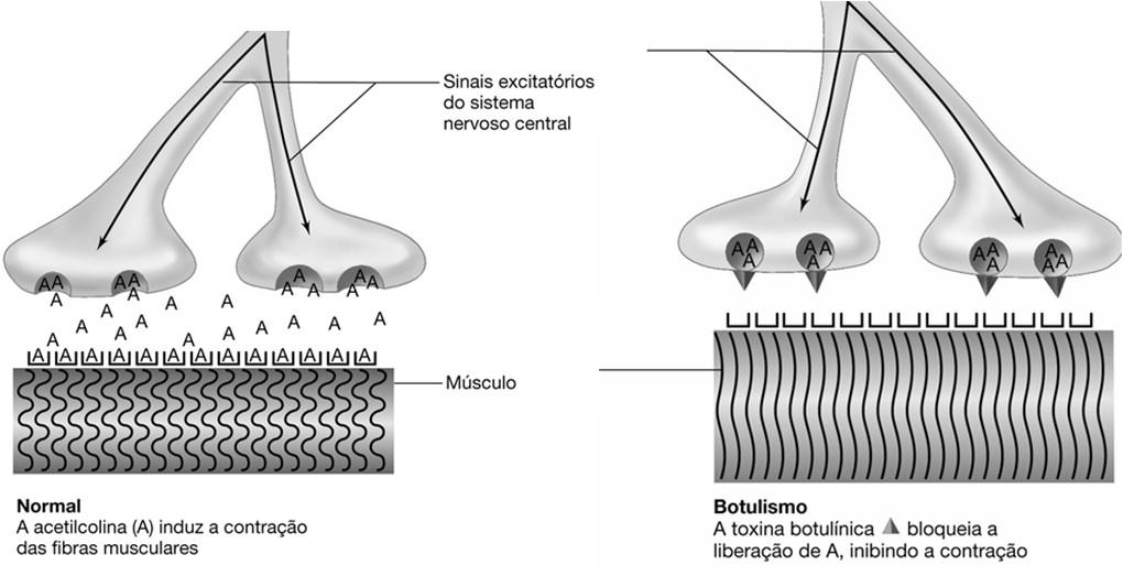 na junção neuro-muscular, bloqueando a liberação